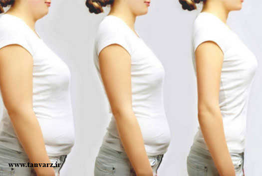 کاهش سایز باسن، ران و شکم